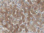 ALDOB Antibody in Immunohistochemistry (Paraffin) (IHC (P))