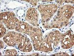 ALDOB Antibody in Immunohistochemistry (Paraffin) (IHC (P))