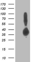 ALDOB Antibody in Western Blot (WB)