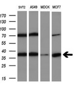 ALDOB Antibody in Western Blot (WB)