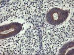 ALG2 Antibody in Immunohistochemistry (Paraffin) (IHC (P))