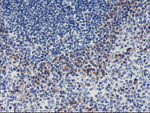 ALG2 Antibody in Immunohistochemistry (Paraffin) (IHC (P))