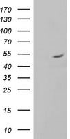 ALG2 Antibody in Western Blot (WB)