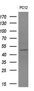 ALG2 Antibody in Western Blot (WB)