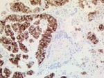 ALK Antibody in Immunohistochemistry (Paraffin) (IHC (P))