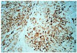 ALK Antibody in Immunohistochemistry (Paraffin) (IHC (P))