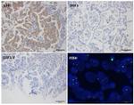 ALK Antibody in Immunohistochemistry (Paraffin) (IHC (P))