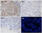 ALK Antibody in Immunohistochemistry (Paraffin) (IHC (P))