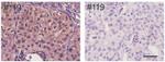 ALK Antibody in Immunohistochemistry (Paraffin) (IHC (P))