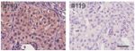 ALK Antibody in Immunohistochemistry (Paraffin) (IHC (P))