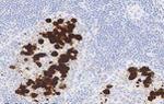 ALK Antibody in Immunohistochemistry (Paraffin) (IHC (P))