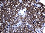 ALK Antibody in Immunohistochemistry (Paraffin) (IHC (P))