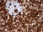 ALK Antibody in Immunohistochemistry (Paraffin) (IHC (P))