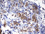 ALK Antibody in Immunohistochemistry (Paraffin) (IHC (P))