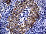 ALK Antibody in Immunohistochemistry (Paraffin) (IHC (P))