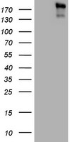 ALK Antibody in Western Blot (WB)