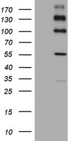 ALK Antibody in Western Blot (WB)