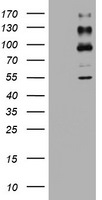 ALK Antibody in Western Blot (WB)