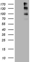 ALK Antibody in Western Blot (WB)