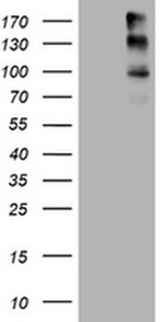 ALK Antibody in Western Blot (WB)