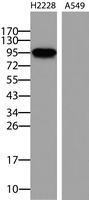 ALK Antibody in Western Blot (WB)