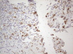 ALOX12 Antibody in Immunohistochemistry (Paraffin) (IHC (P))