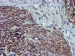 ALOX15 Antibody in Immunohistochemistry (Paraffin) (IHC (P))