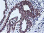 ALOX15 Antibody in Immunohistochemistry (Paraffin) (IHC (P))