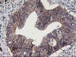 ALOX15 Antibody in Immunohistochemistry (Paraffin) (IHC (P))