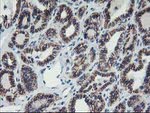 ALOX15 Antibody in Immunohistochemistry (Paraffin) (IHC (P))