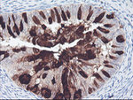 ALOX15 Antibody in Immunohistochemistry (Paraffin) (IHC (P))