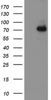 ALOX15 Antibody in Western Blot (WB)