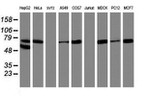 ALOX15 Antibody in Western Blot (WB)