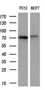 ALOX15 Antibody in Western Blot (WB)