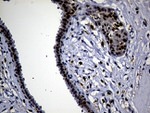 ALOX5 Antibody in Immunohistochemistry (Paraffin) (IHC (P))