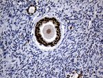 ALOX5 Antibody in Immunohistochemistry (Paraffin) (IHC (P))