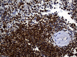 ALOX5 Antibody in Immunohistochemistry (Paraffin) (IHC (P))