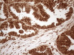 ALOX5 Antibody in Immunohistochemistry (Paraffin) (IHC (P))