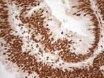 ALOX5 Antibody in Immunohistochemistry (Paraffin) (IHC (P))