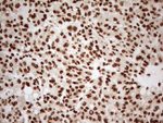 ALOX5 Antibody in Immunohistochemistry (Paraffin) (IHC (P))