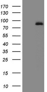 ALOX5 Antibody in Western Blot (WB)