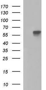 ALPP Antibody in Western Blot (WB)