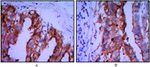 Placental Alkaline Phosphatase Antibody in Immunohistochemistry (Paraffin) (IHC (P))