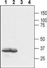 LPAR2 (EDG4) (extracellular) Antibody in Western Blot (WB)