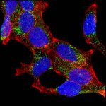 AMACR Antibody in Immunocytochemistry (ICC/IF)