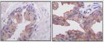 AMACR Antibody in Immunohistochemistry (Paraffin) (IHC (P))