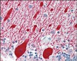 AMACR Antibody in Immunohistochemistry (Paraffin) (IHC (P))