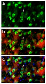 TNF alpha Antibody in Immunocytochemistry (ICC/IF)