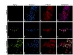 TNF alpha Antibody