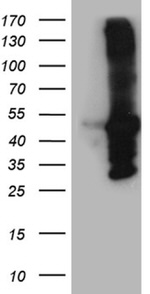 AMDHD1 Antibody in Western Blot (WB)